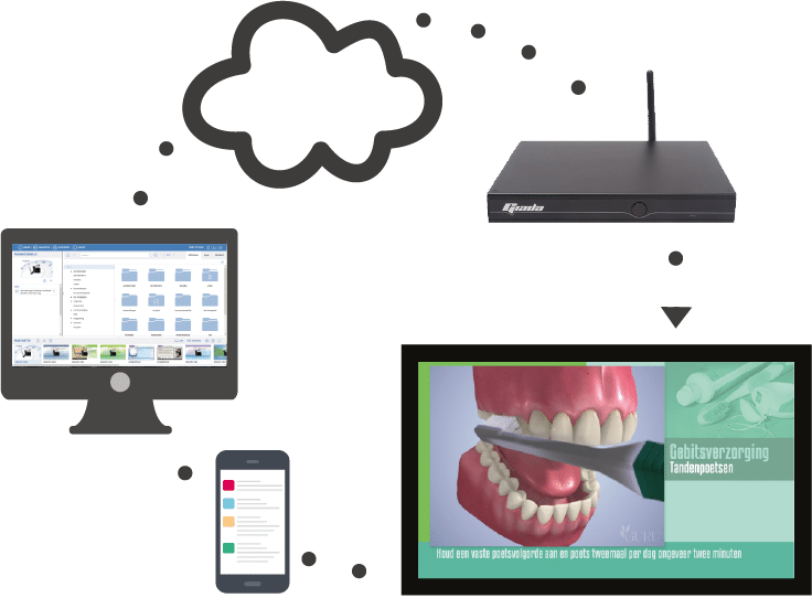 Hoe werkt het diagram
